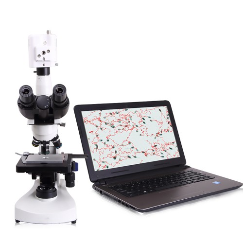 Portable Veterinary Sperm Analysis Semen Analyzer Canine Semen Analyzer