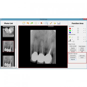Handy HDR 500 Veterinary Dental Xray Sensor USB Handheld Digital Intraoral Sensors