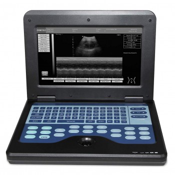 CONTEC CMS600P2-Vet Veterinary use Portable Laptop B-Ultra Sound Scanner Machine for Horse/Equine/Cow/Sheep use
