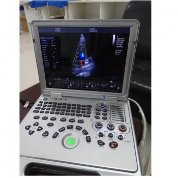 HUC-250 Portable 2D/3D Color Doppler Ultrasonic Diagnostic System Animal Laptop Ultrasound Scanner