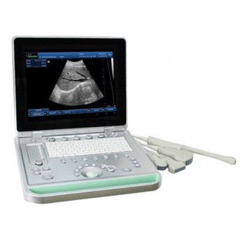 Sonostar V-9 Portable Vet Ultrasound Scanner Veterinary Ultrasound Machine with Micro Convex Probe