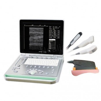 Sonostar V-7 Full Digital Vet Laptop Ultrasound Scanner Veterinary Ultrasound Ma...