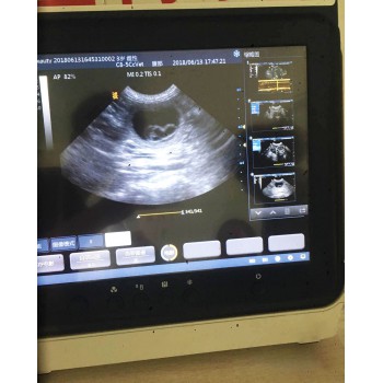 BMV MX-50A Touch Screen Portable Veterinary B/W Ultrasound Scanner