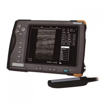 Sonostar V5 Full Digital Handheld Palm B/W Veterinary Ultrasound Scanner Vet Doppler Ultrasound Machine