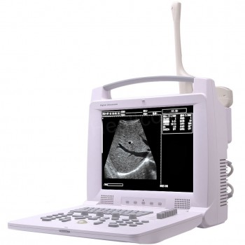 Veterinary B/W Ultrasound scanner Vet Ultrasound Machine HV-3018