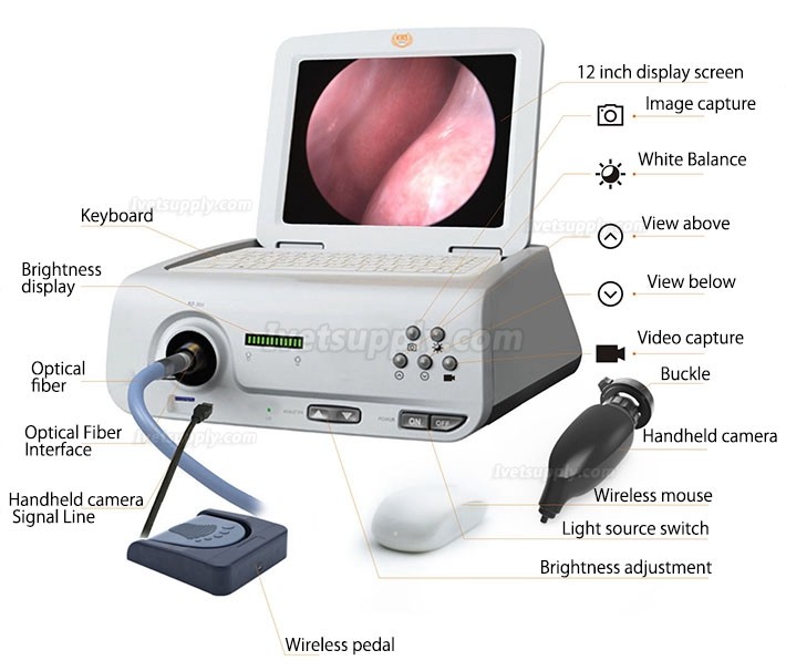 KWS SD-602K-1 80W LED portable endoscope camera full HD 1080P integrated CCD camera KWS SD-602K-1 80W LED portable endoscope camera full HD 1080P integrated CCD camera