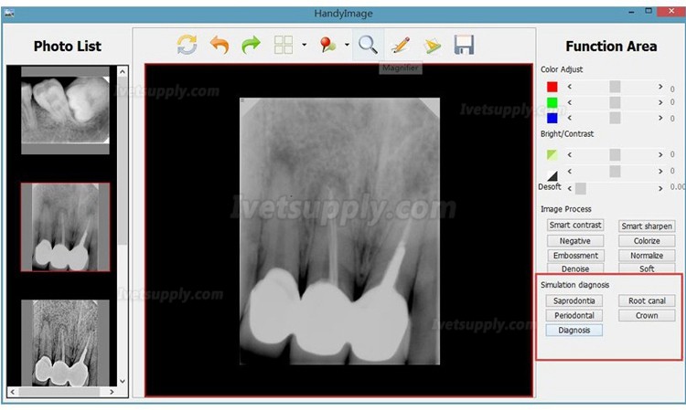 Portable Veterinary Dental X ray Machine AD-60P + Handy HDR 500/600 Dental X-ray Sensor