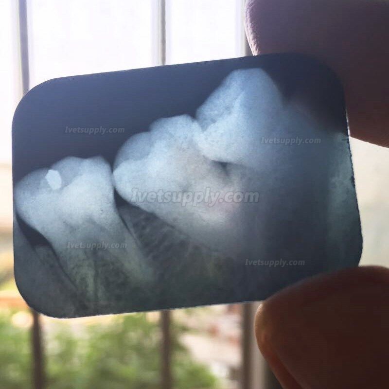 Portable Veterinary Dental X-Ray Machine BLX-10 Digital X-Ray Unit Equipment