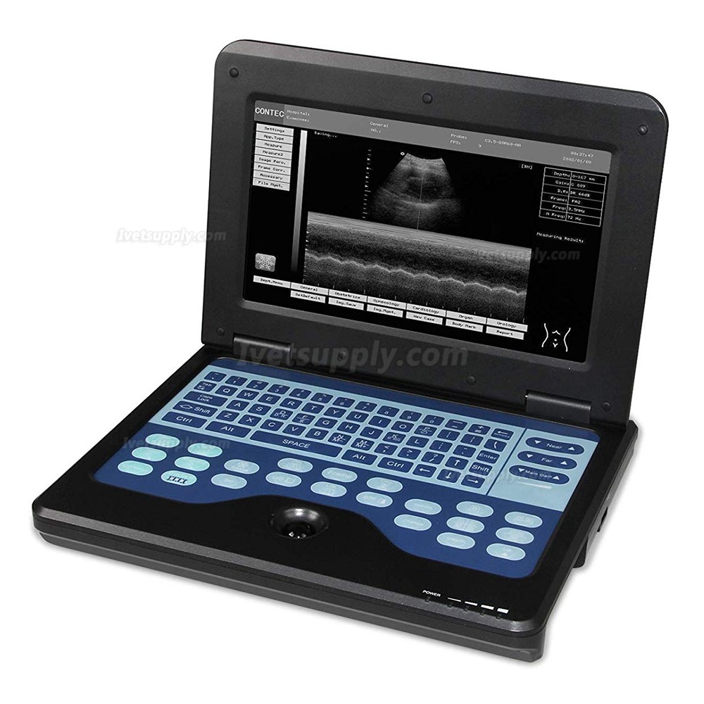 CONTEC CMS600P2-Vet Veterinary use Portable Laptop B-Ultra Sound Scanner Machine for Horse/Equine/Cow/Sheep use