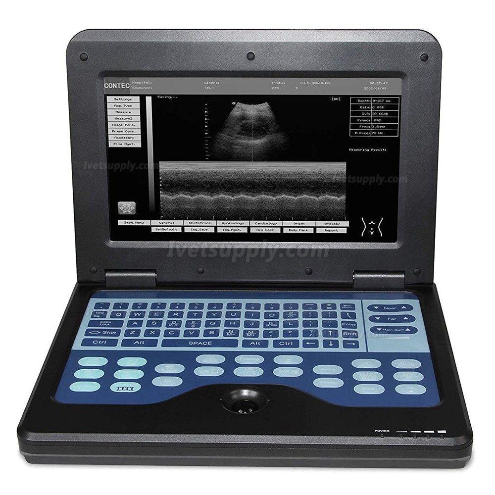 CONTEC CMS600P2-Vet Veterinary use Portable Laptop B-Ultra Sound Scanner Machine for Horse/Equine/Cow/Sheep use