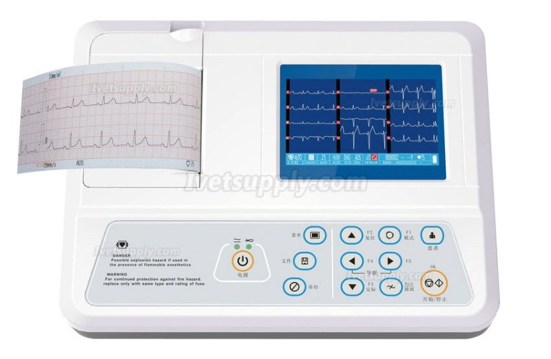 Veterinary Three Channels ECG Machine Automatic Arrythmia Analysis Medical Equipment