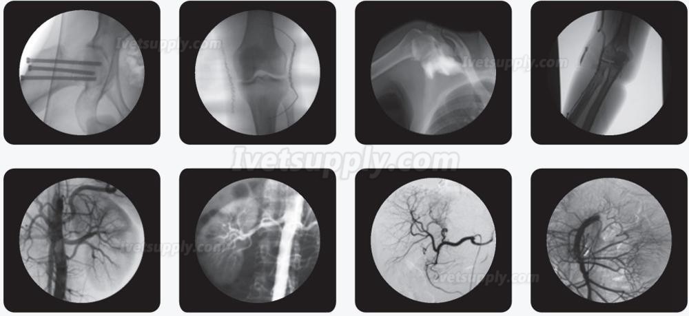 Portable X Ray Flat Panel Digital Flat Venu 1717X Detector