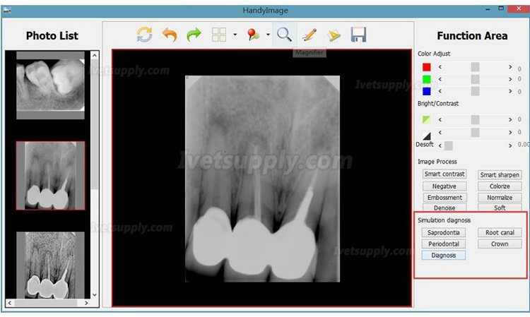 Handy HDR 500 Veterinary Dental Xray Sensor USB Handheld Digital Intraoral Sensors Handy HDR 500 Veterinary Dental Xray Sensor USB Handheld Digital Intraoral Sensors