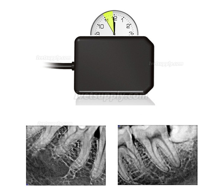 Handy HDR 500 Veterinary Dental Xray Sensor USB Handheld Digital Intraoral Sensors Handy HDR 500 Veterinary Dental Xray Sensor USB Handheld Digital Intraoral Sensors