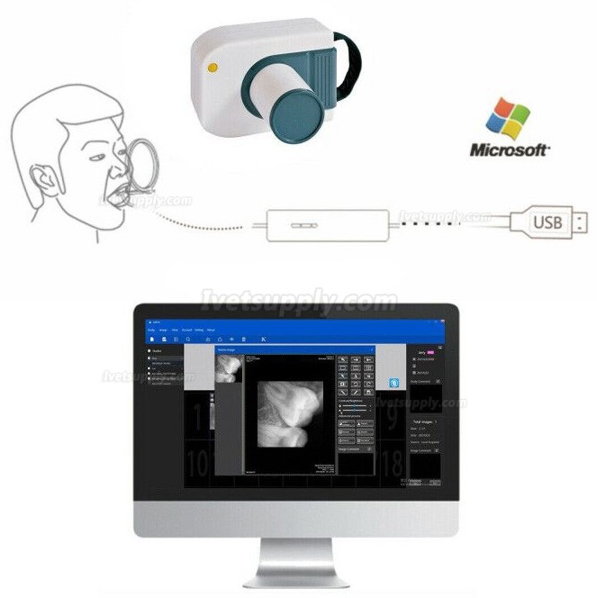 Veterinary Dental Digital Image RVG X-Ray Sensor Dental Intraoral Imaging System