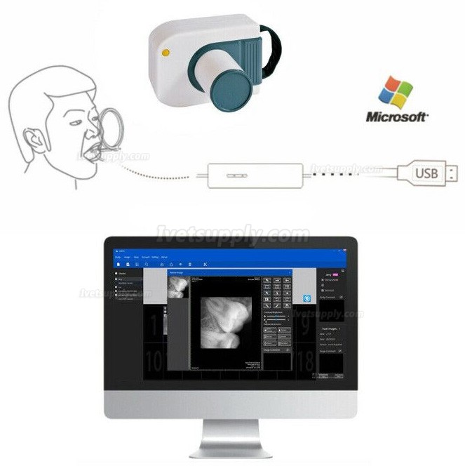 Veterinary Dental Digital Image RVG X-Ray Sensor Dental Intraoral Imaging System Veterinary Dental Digital Image RVG X-Ray Sensor Dental Intraoral Imaging System