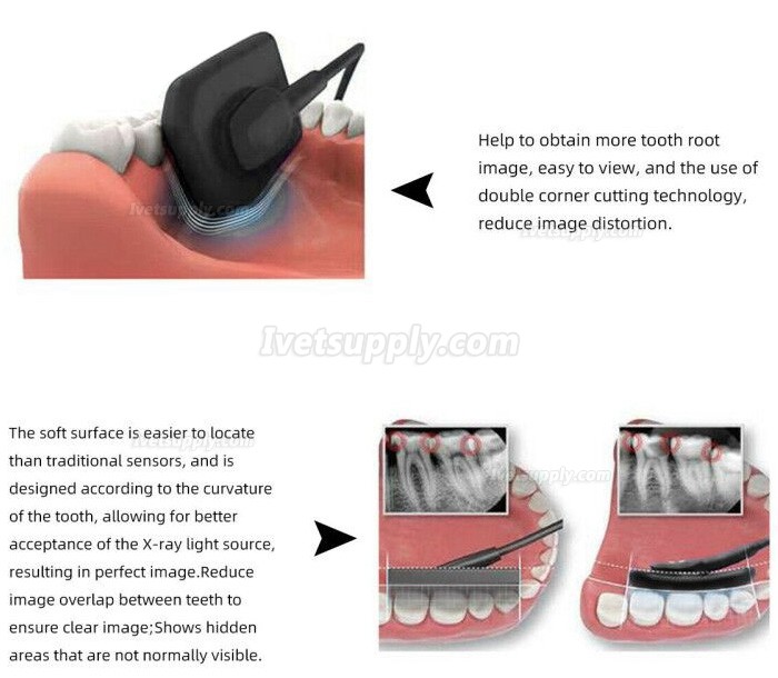 Veterinary Dental Digital Image RVG X-Ray Sensor Dental Intraoral Imaging System