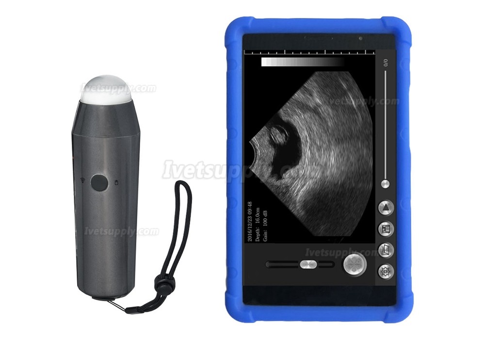 S3 Full Digital WIFI Wireless Handheld Vet Ultrasound Scanner Portable Ultrasonic Diagnostic System