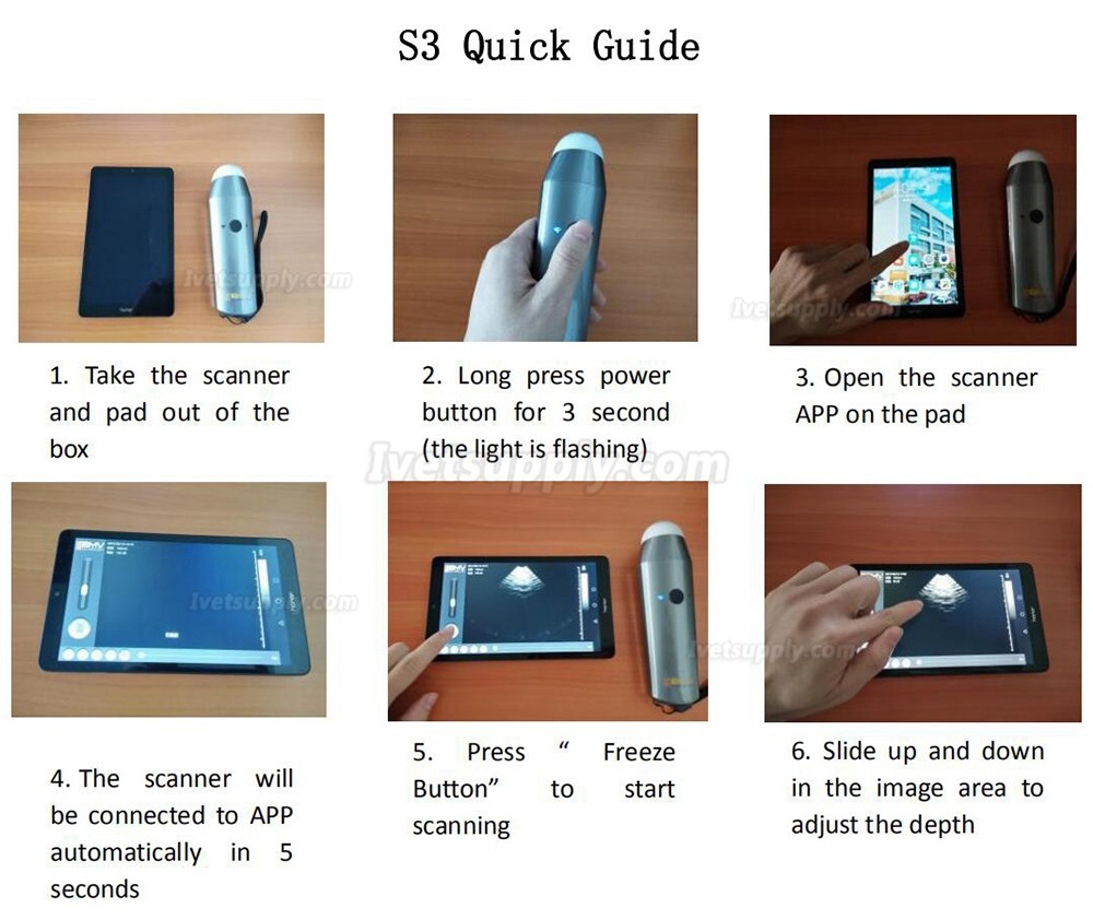 S3 Full Digital WIFI Wireless Handheld Vet Ultrasound Scanner Portable Ultrasonic Diagnostic System