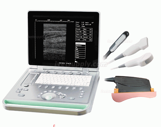 Sonostar V-7 Full Digital Vet Laptop Ultrasound Scanner Veterinary Ultrasound Machine