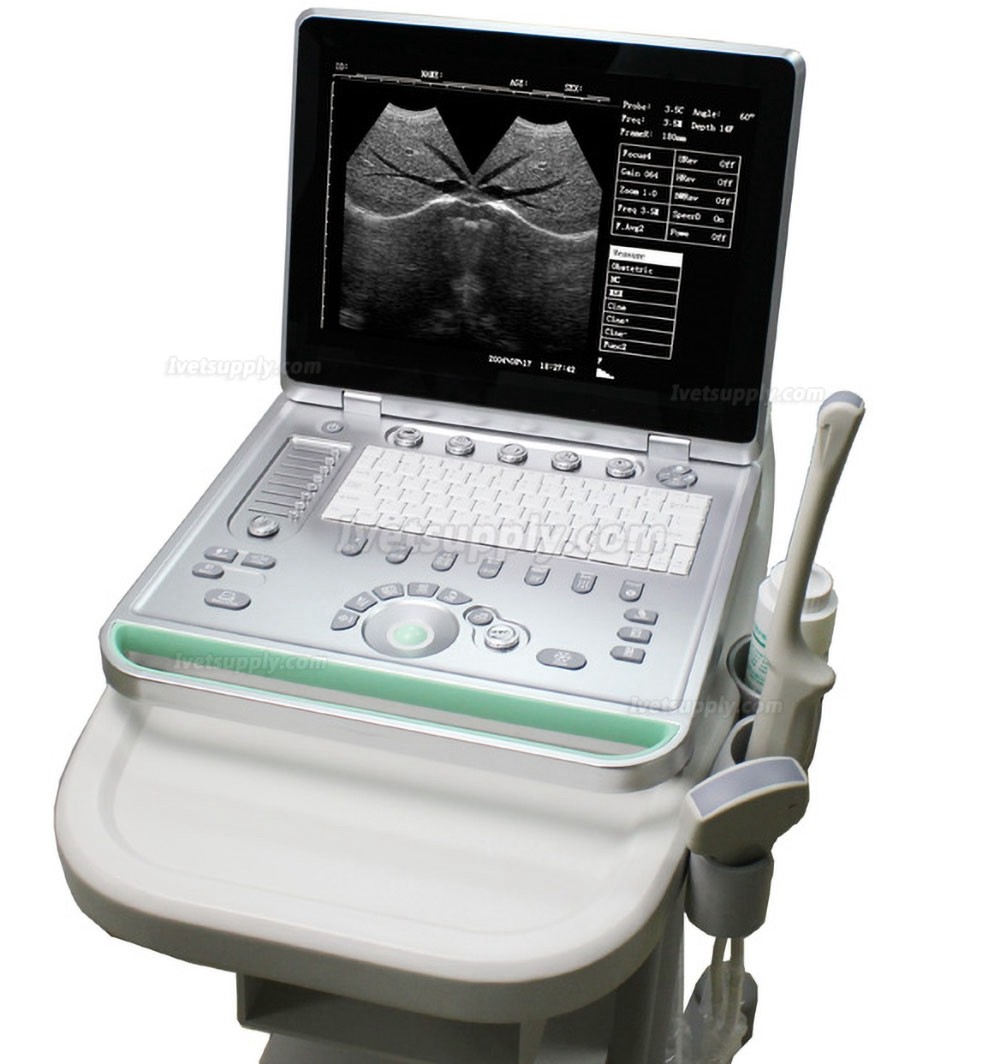 Sonostar V-7 Full Digital Vet Laptop Ultrasound Scanner Veterinary Ultrasound Machine