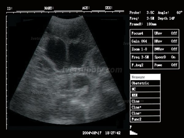 Sonostar V-7 Full Digital Vet Laptop Ultrasound Scanner Veterinary Ultrasound Machine
