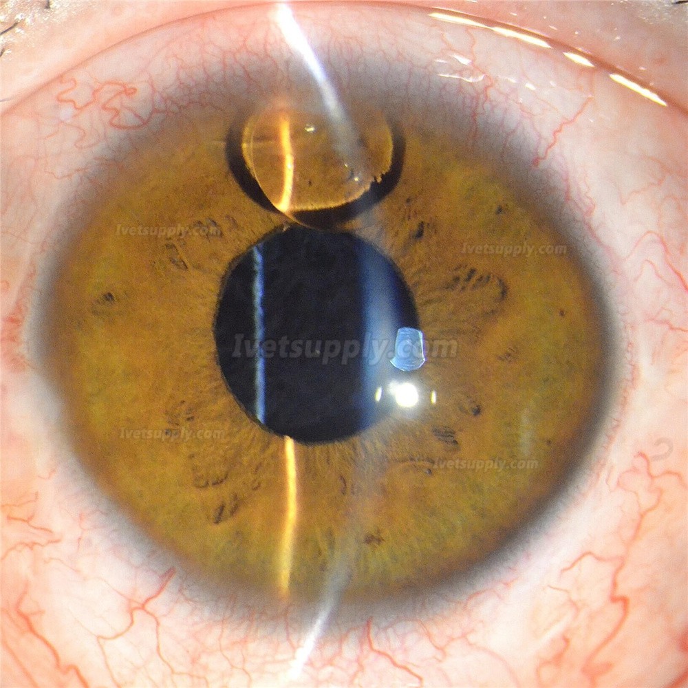 Veterinary Tabletop Slit Lamp Optical Ophthalmic Equipment Digital Slit ...