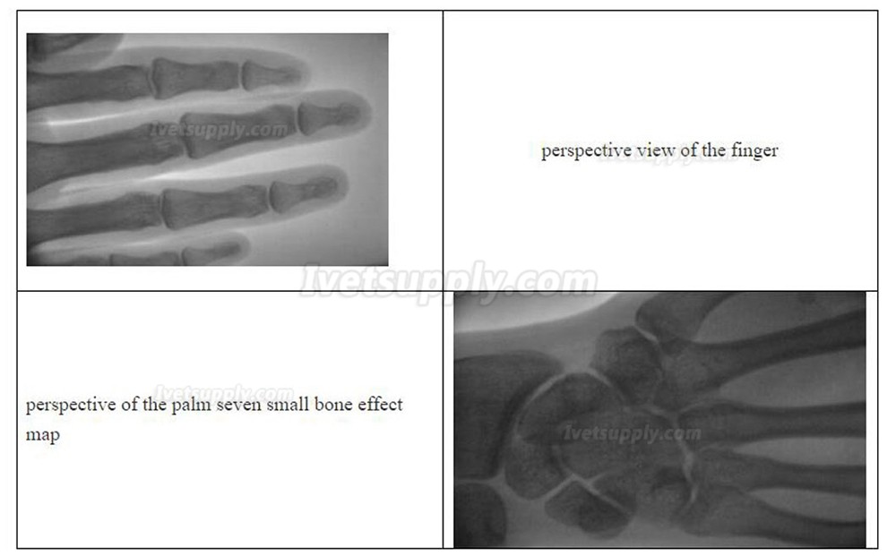 Veterinary Portable X-ray Machine Vet Xray Machine